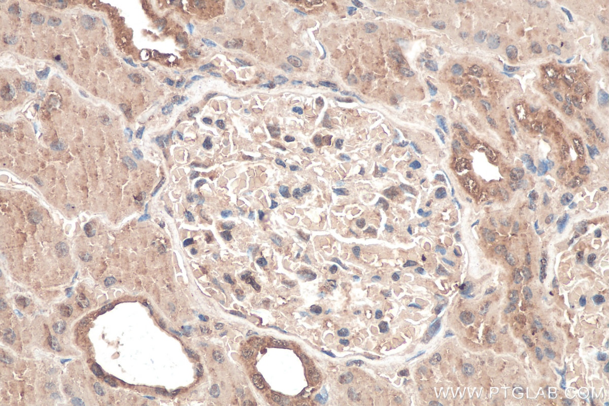 Immunohistochemistry (IHC) staining of human kidney tissue using Calumenin Monoclonal antibody (67585-1-Ig)