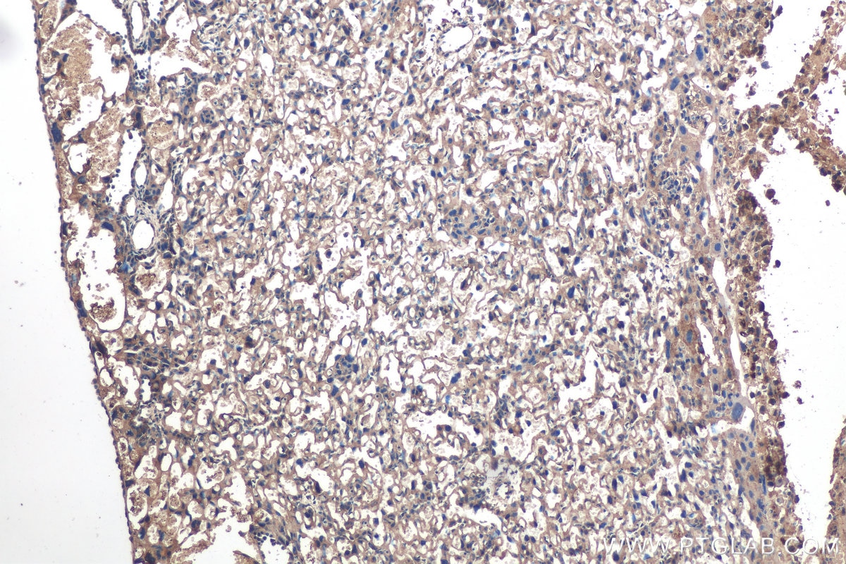 Immunohistochemistry (IHC) staining of mouse placenta tissue using Calumenin Monoclonal antibody (67585-1-Ig)