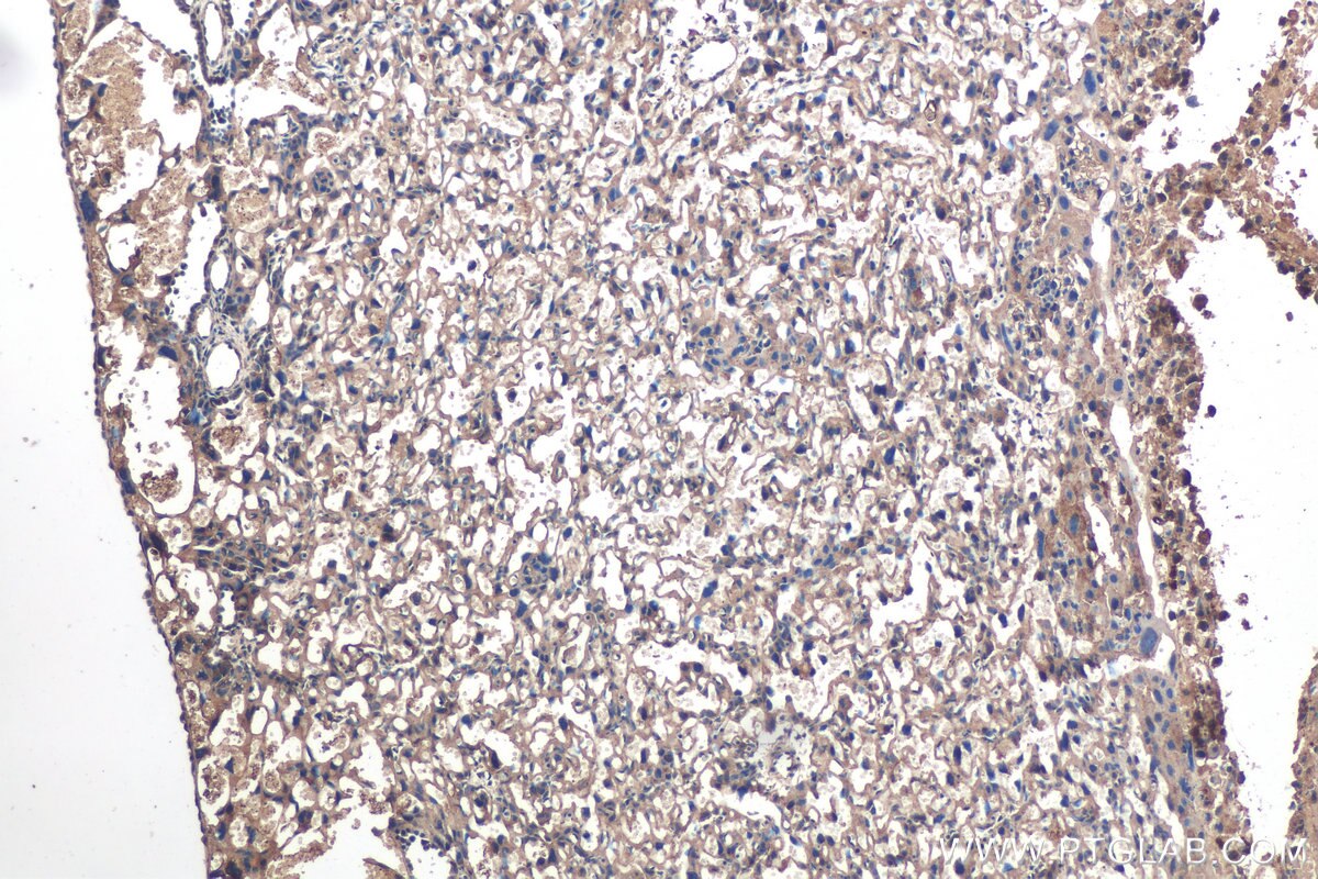 IHC staining of mouse placenta using 67585-1-Ig