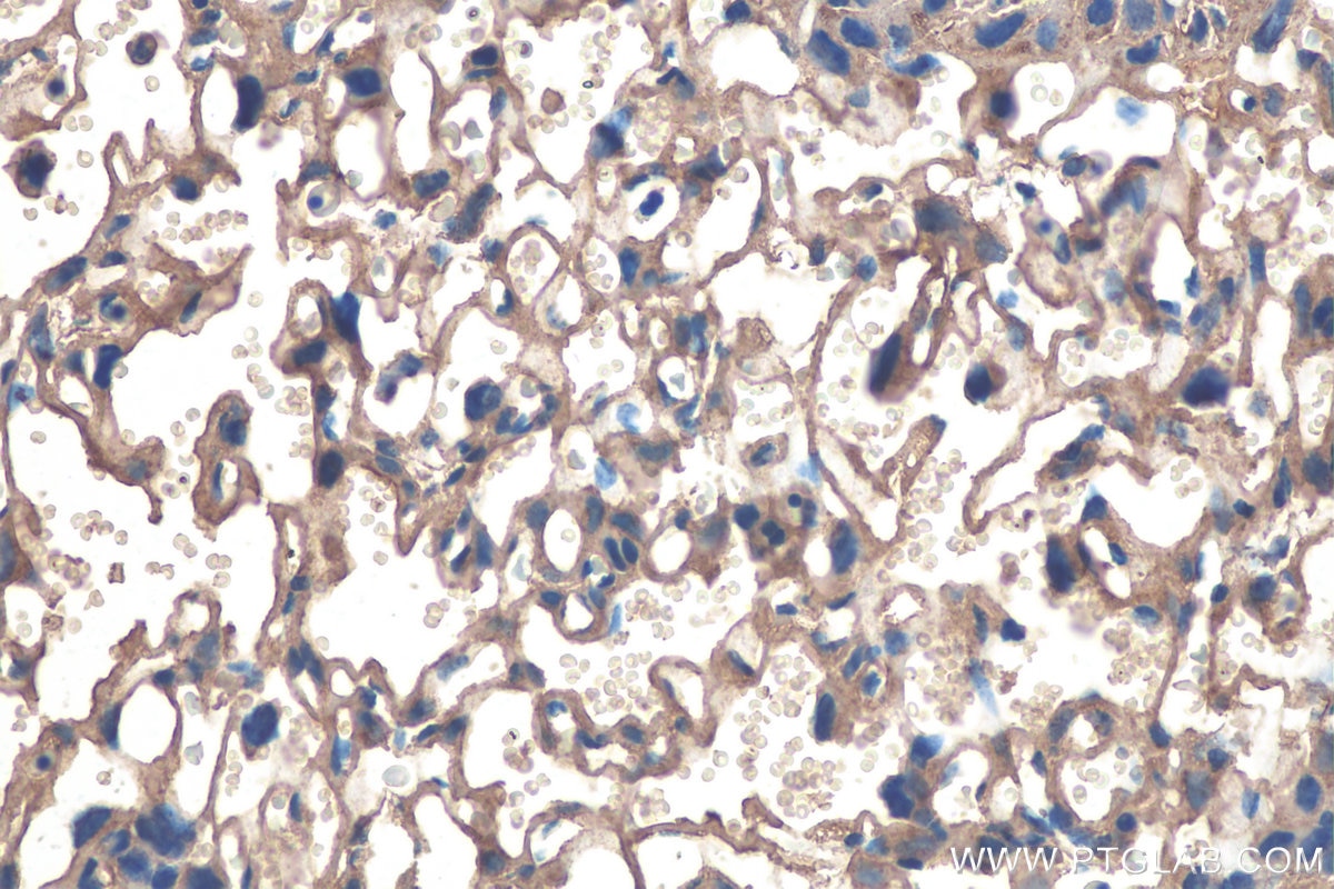 Immunohistochemistry (IHC) staining of mouse placenta tissue using Calumenin Monoclonal antibody (67585-1-Ig)
