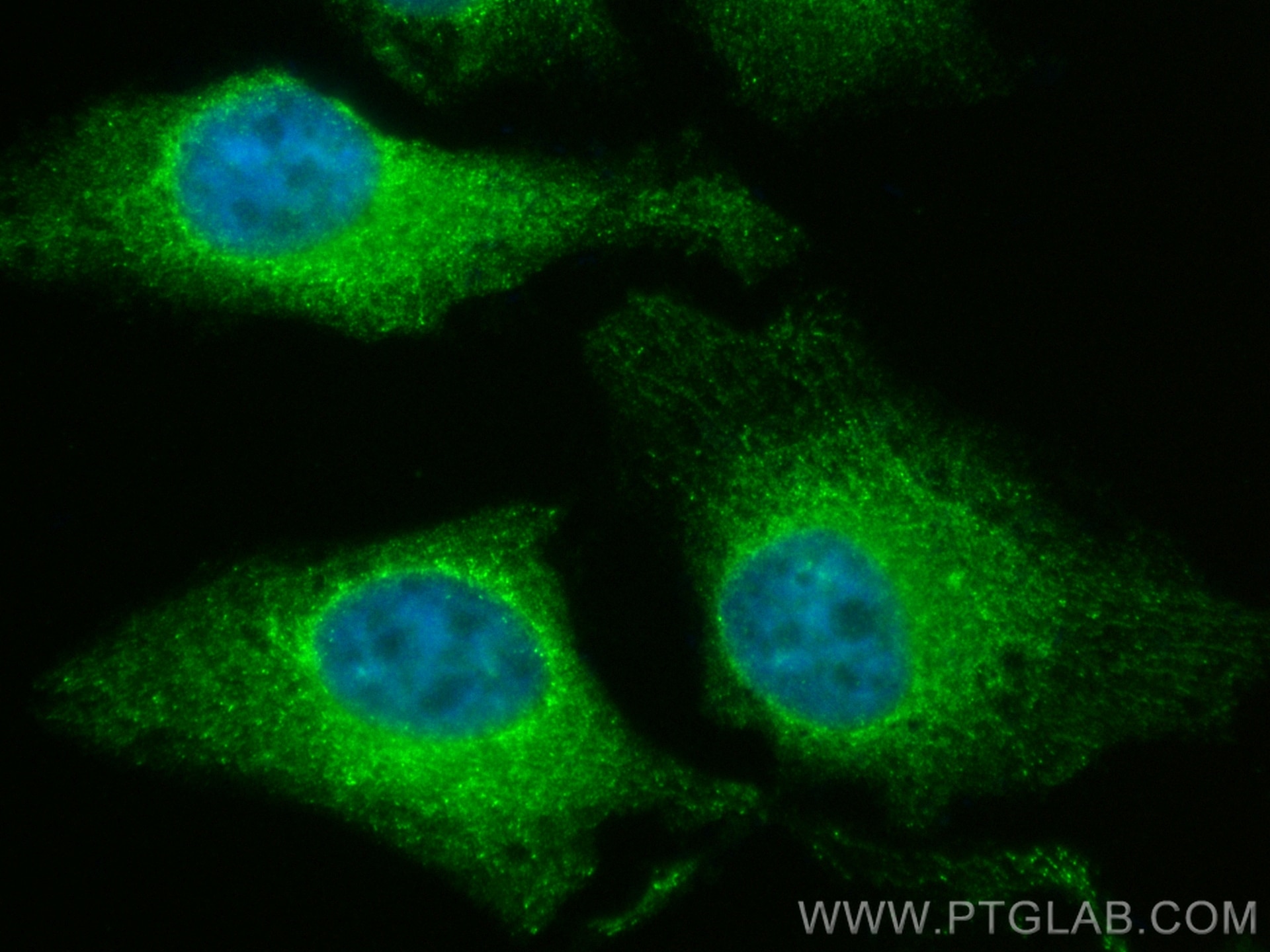 IF Staining of HeLa using CL488-67585