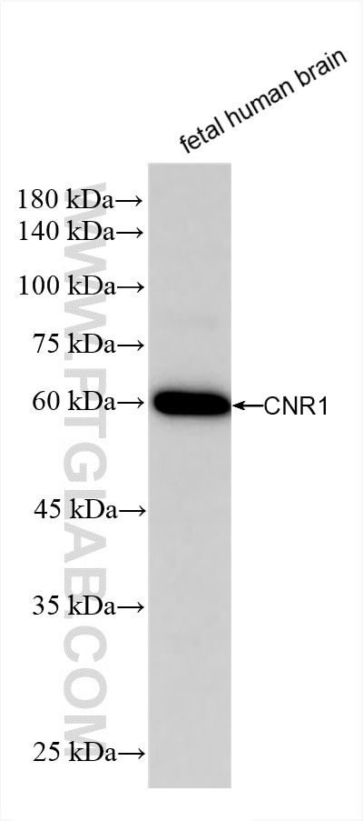 Western Blot (WB) analysis of fetal human brain tissue using Cannabinoid receptor 1 Recombinant antibody (82787-2-RR)