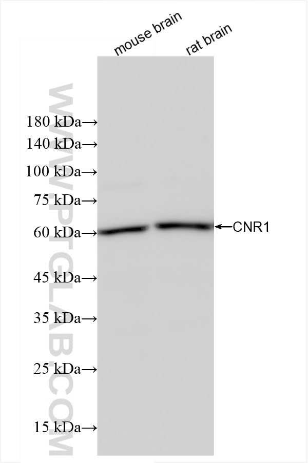 Western Blot (WB) analysis of various lysates using Cannabinoid receptor 1 Recombinant antibody (82787-3-RR)