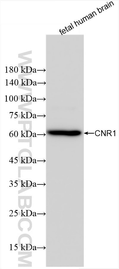 Western Blot (WB) analysis of fetal human brain tissue using Cannabinoid receptor 1 Recombinant antibody (82787-3-RR)