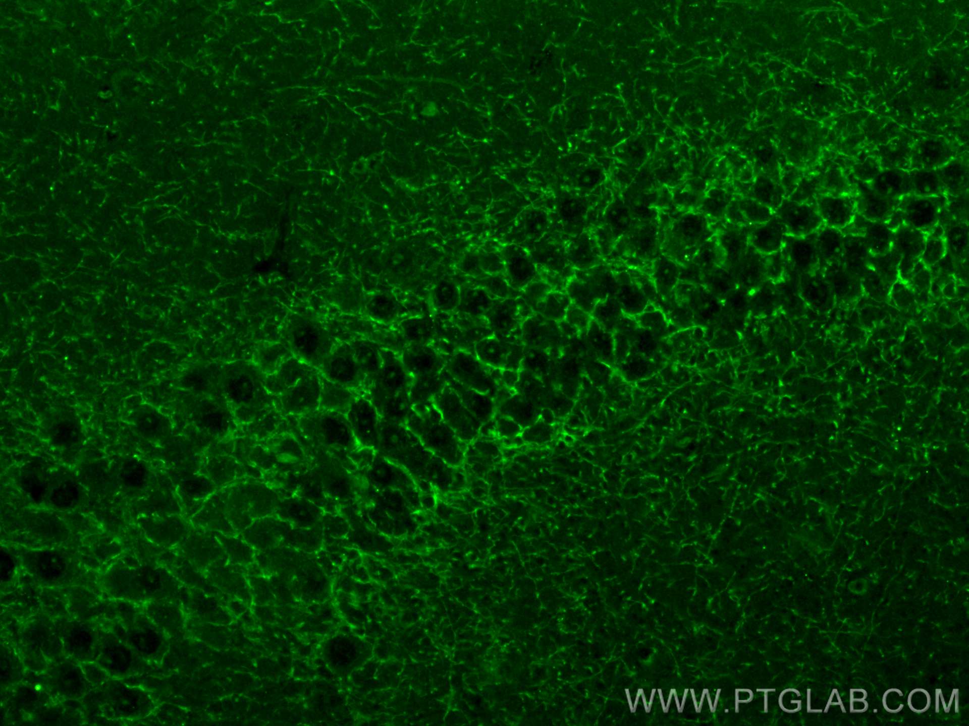 Cannabinoid receptor 1