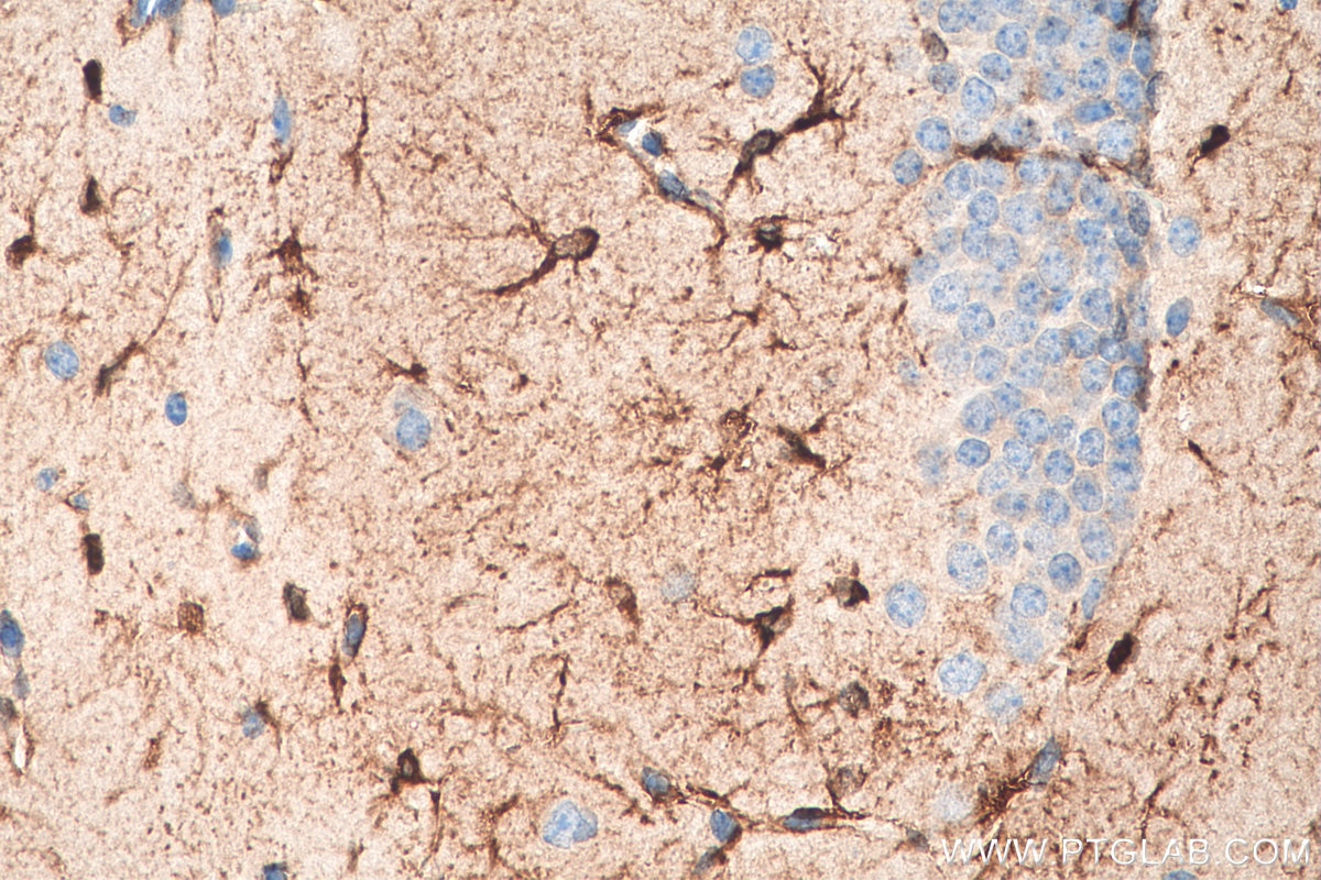 Immunohistochemistry (IHC) staining of mouse brain tissue using Cannabinoid receptor 2 Polyclonal antibody (29371-1-AP)