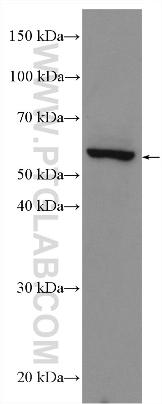 Western Blot (WB) analysis of MCF-7 cells using Cannabinoid receptor 2 Polyclonal antibody (29371-1-AP)
