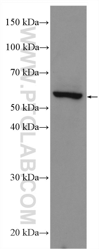 WB analysis of MCF-7 using 29371-1-AP