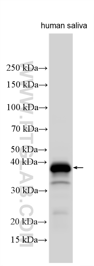 Western Blot (WB) analysis of various lysates using Carbonic Anhydrase 6/CA6 Polyclonal antibody (26490-1-AP)