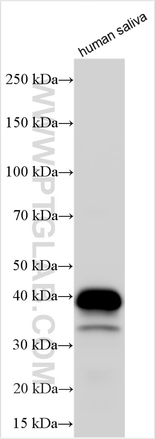 Carbonic Anhydrase 6/CA6