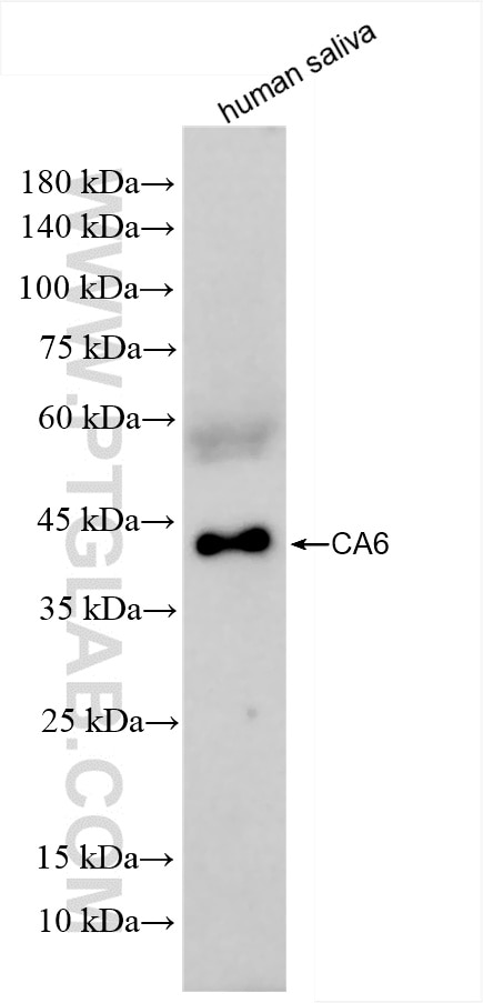 Carbonic Anhydrase 6/CA6