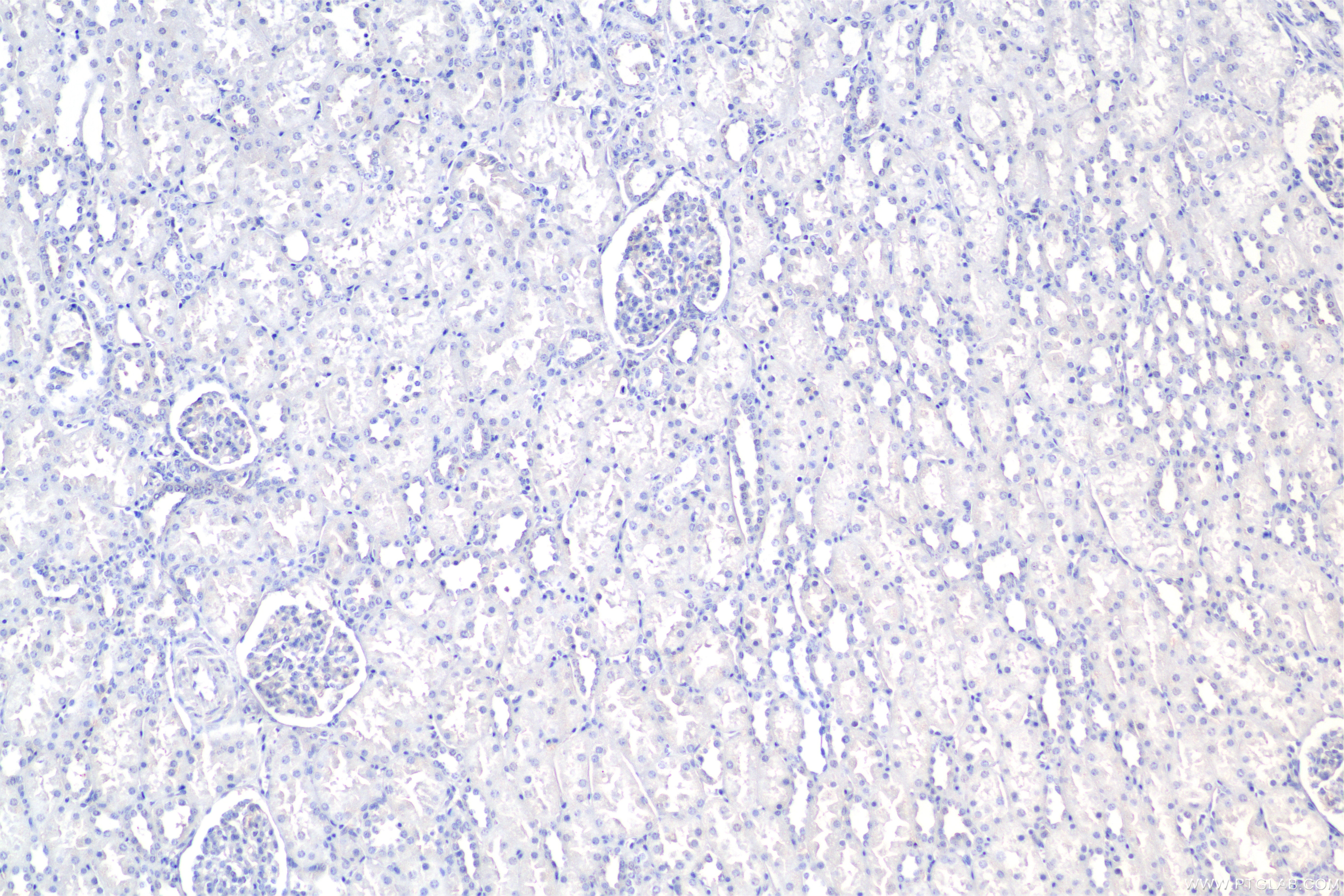 IHC staining of human kidney using 84233-8-RR Immunohistochemistry (IHC) staining of human kidney tissue using Carbonic Anhydrase IX/CA9 Recombinant monoclonal a (84233-8-RR)