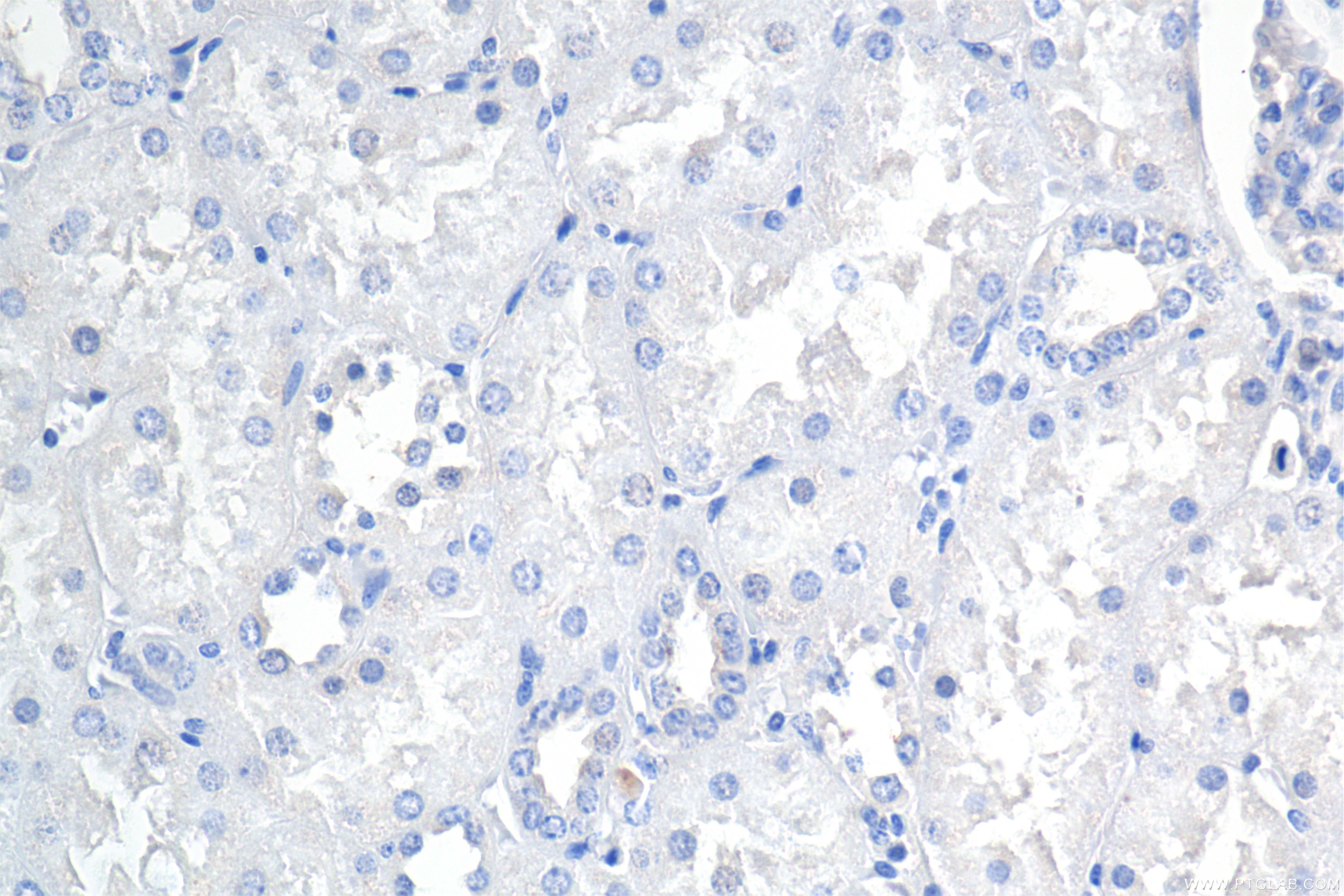 IHC staining of human kidney using 84233-8-RR Immunohistochemistry (IHC) staining of human kidney tissue using Carbonic Anhydrase IX/CA9 Recombinant monoclonal a (84233-8-RR)