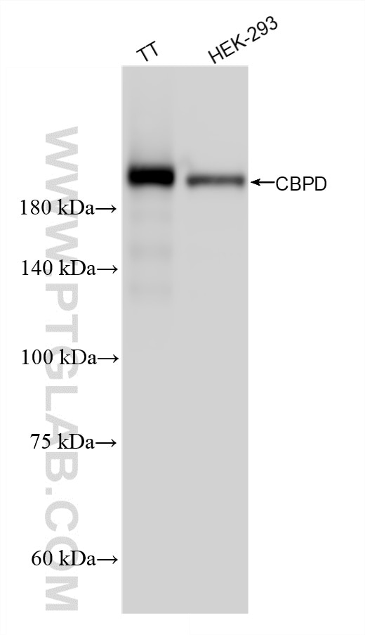 Western Blot (WB) analysis of various lysates using Carboxypeptidase D/CPD Recombinant monoclonal anti (83229-5-RR)