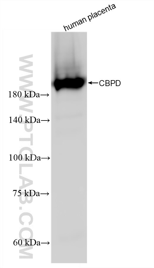 Western Blot (WB) analysis of various lysates using Carboxypeptidase D/CPD Recombinant monoclonal anti (83229-5-RR)