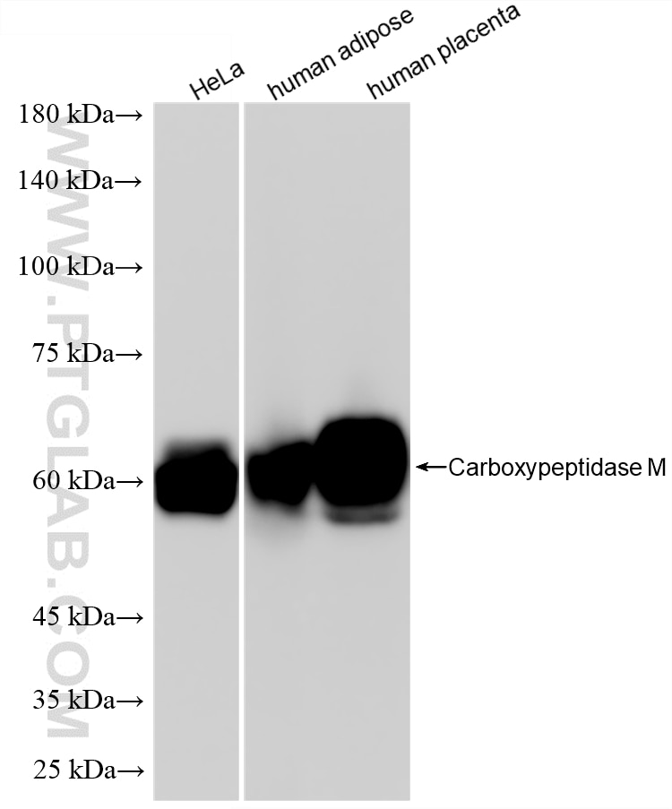 Western Blot (WB) analysis of various lysates using Carboxypeptidase M Recombinant monoclonal antibody (87661-1-RR)