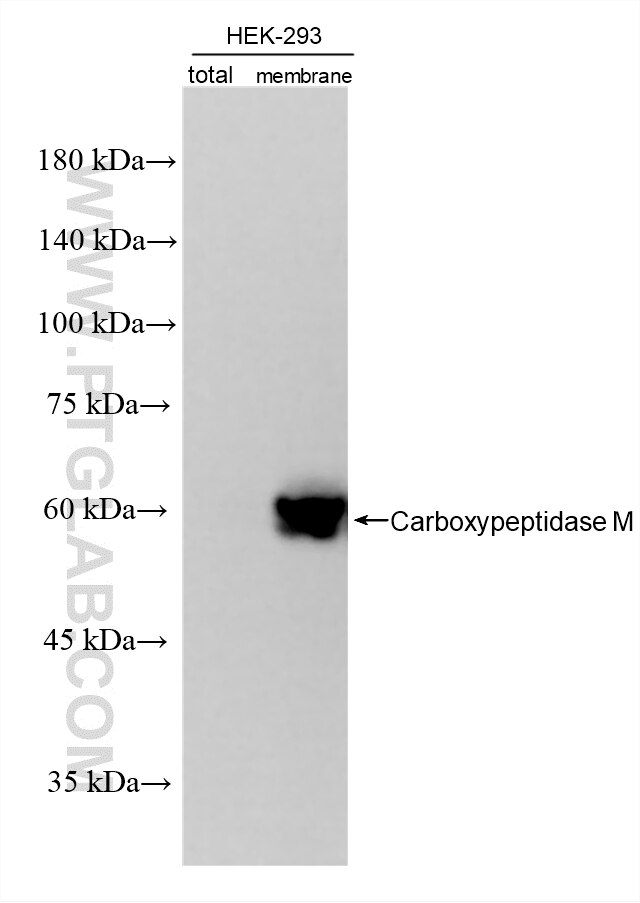 Western Blot (WB) analysis of various lysates using Carboxypeptidase M Recombinant monoclonal antibody (87661-1-RR)