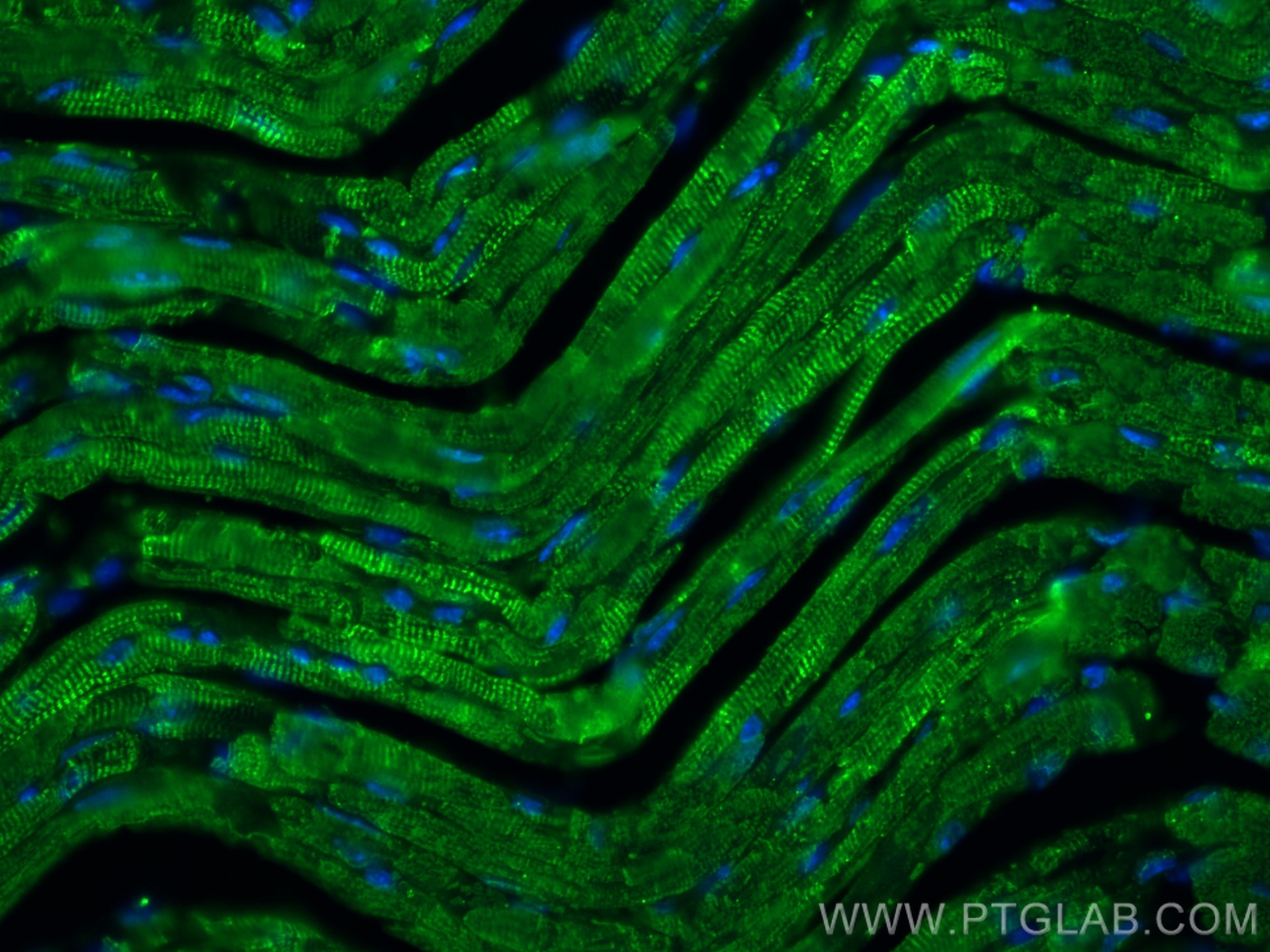 Immunofluorescence (IF) / fluorescent staining of mouse heart tissue using Cardiac Troponin I Monoclonal antibody (66376-1-Ig)