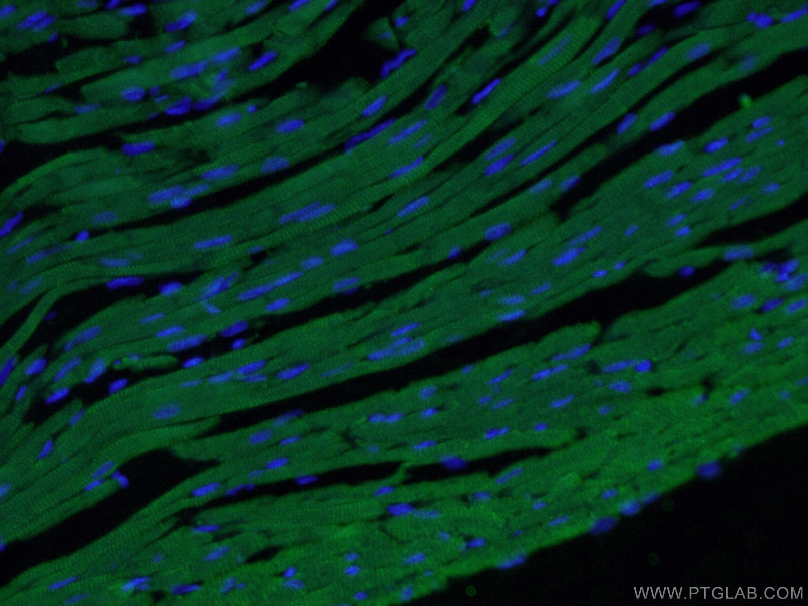 Immunofluorescence (IF) / fluorescent staining of mouse heart tissue using Cardiac Troponin I Monoclonal antibody (66376-1-Ig)