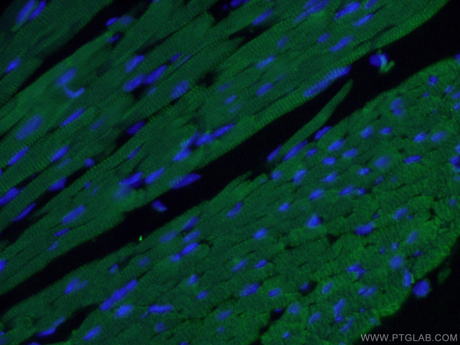 Immunofluorescence (IF) / fluorescent staining of mouse heart tissue using Cardiac Troponin I Monoclonal antibody (66376-1-Ig)