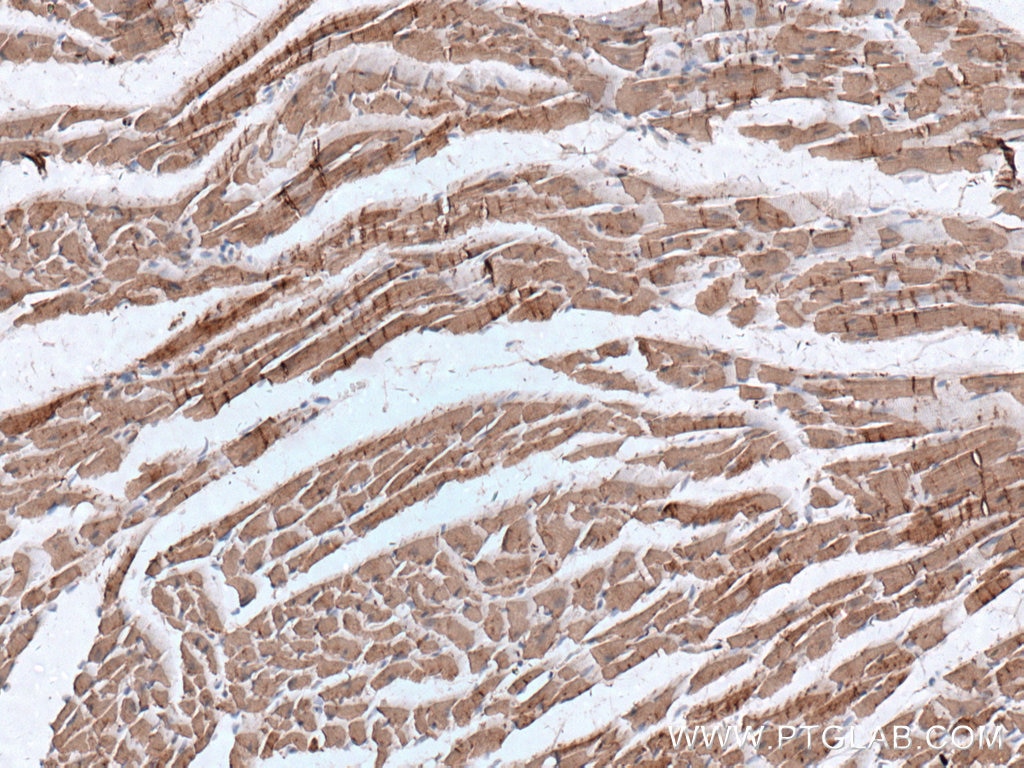 Immunohistochemistry (IHC) staining of mouse heart tissue using Cardiac Troponin I Monoclonal antibody (66376-1-Ig)