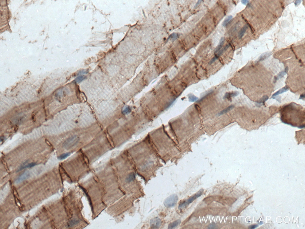 Immunohistochemistry (IHC) staining of mouse heart tissue using Cardiac Troponin I Monoclonal antibody (66376-1-Ig)