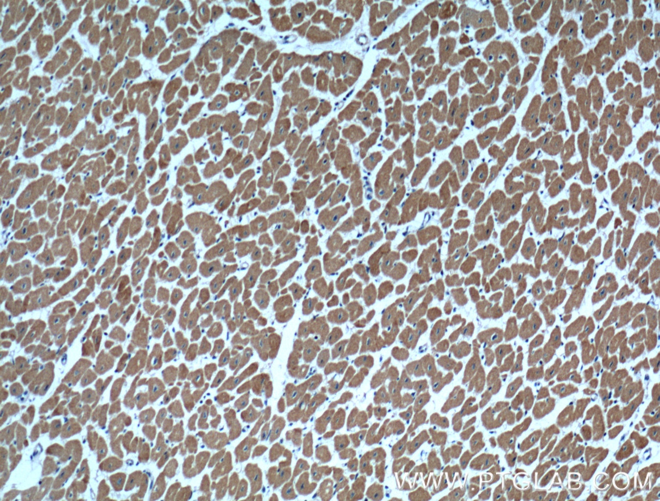 Immunohistochemistry (IHC) staining of human heart tissue using Cardiac Troponin I Monoclonal antibody (66376-1-Ig)