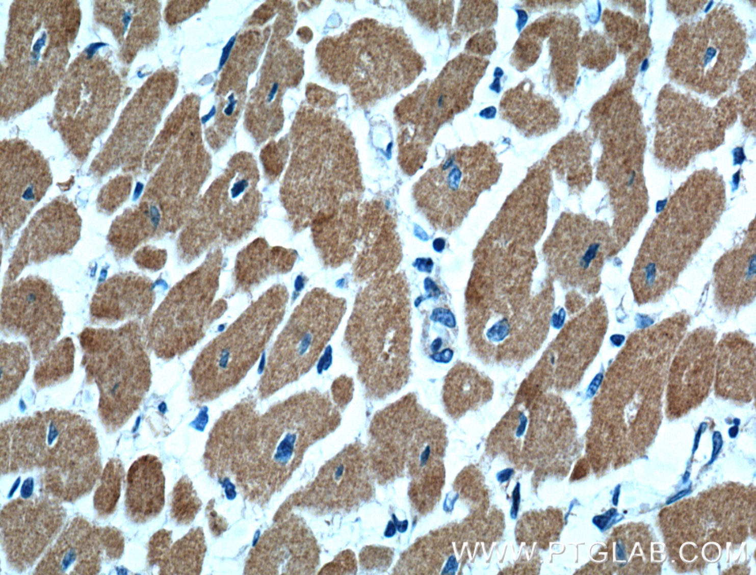 Immunohistochemistry (IHC) staining of human heart tissue using Cardiac Troponin I Monoclonal antibody (66376-1-Ig)