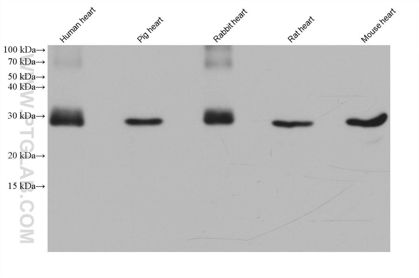 Western Blot (WB) analysis of various lysates using Cardiac Troponin I Monoclonal antibody (66376-1-Ig)