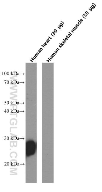 Western Blot (WB) analysis of human heart tissue using Cardiac Troponin I Monoclonal antibody (66376-1-Ig)