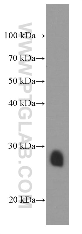 Western Blot (WB) analysis of rat heart tissue using Cardiac Troponin I Monoclonal antibody (66376-1-Ig)