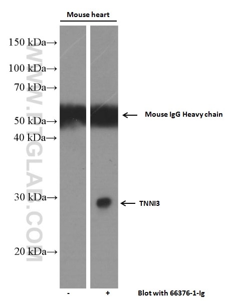 WB analysis of mouse heart using 66376-1-Ig