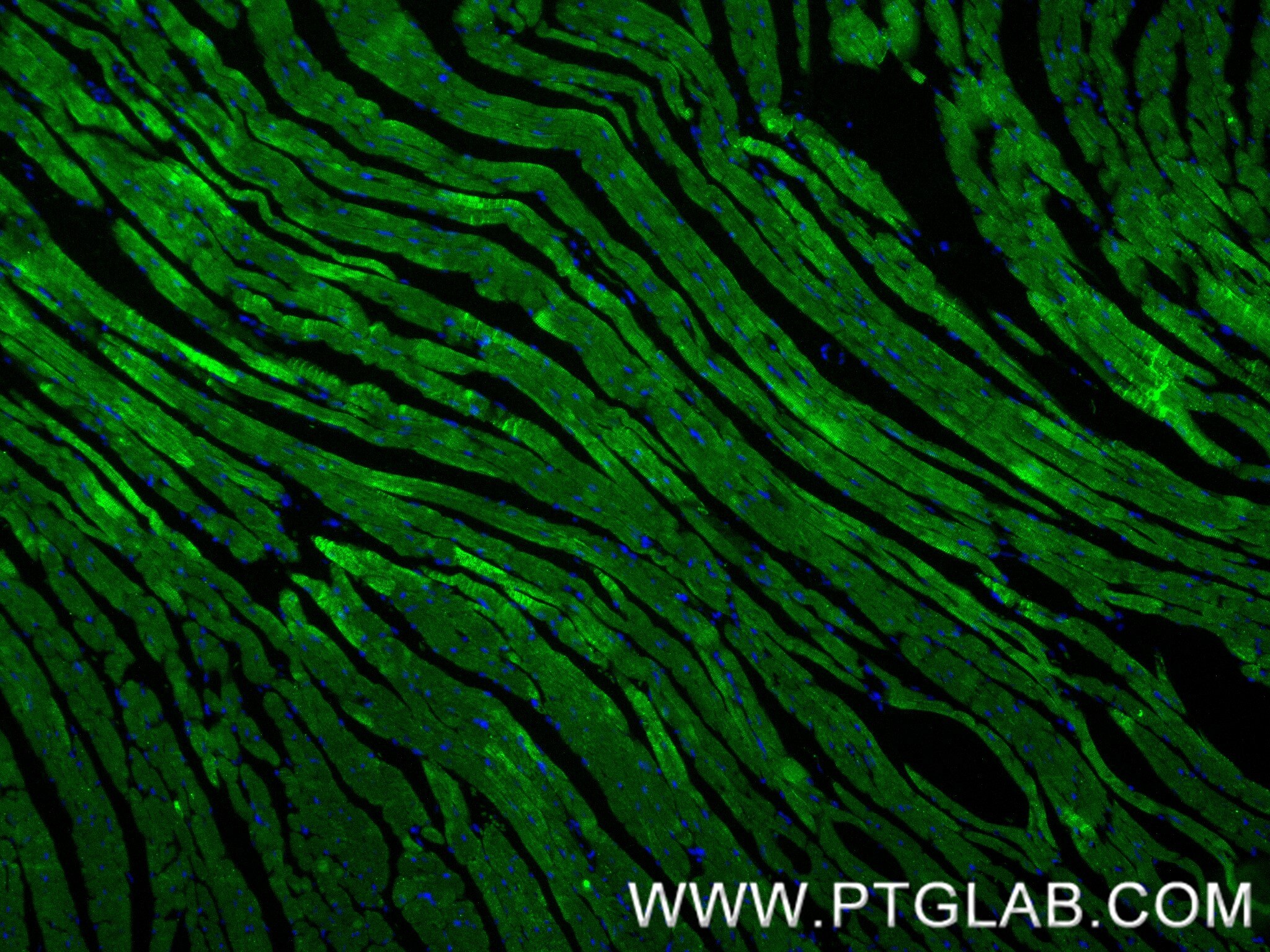 IF Staining of mouse heart using 86791-1-RR Immunofluorescence (IF) / fluorescent staining of mouse heart tissue using Cardiac Troponin I Recombinant monoclonal antibody (86791-1-RR)