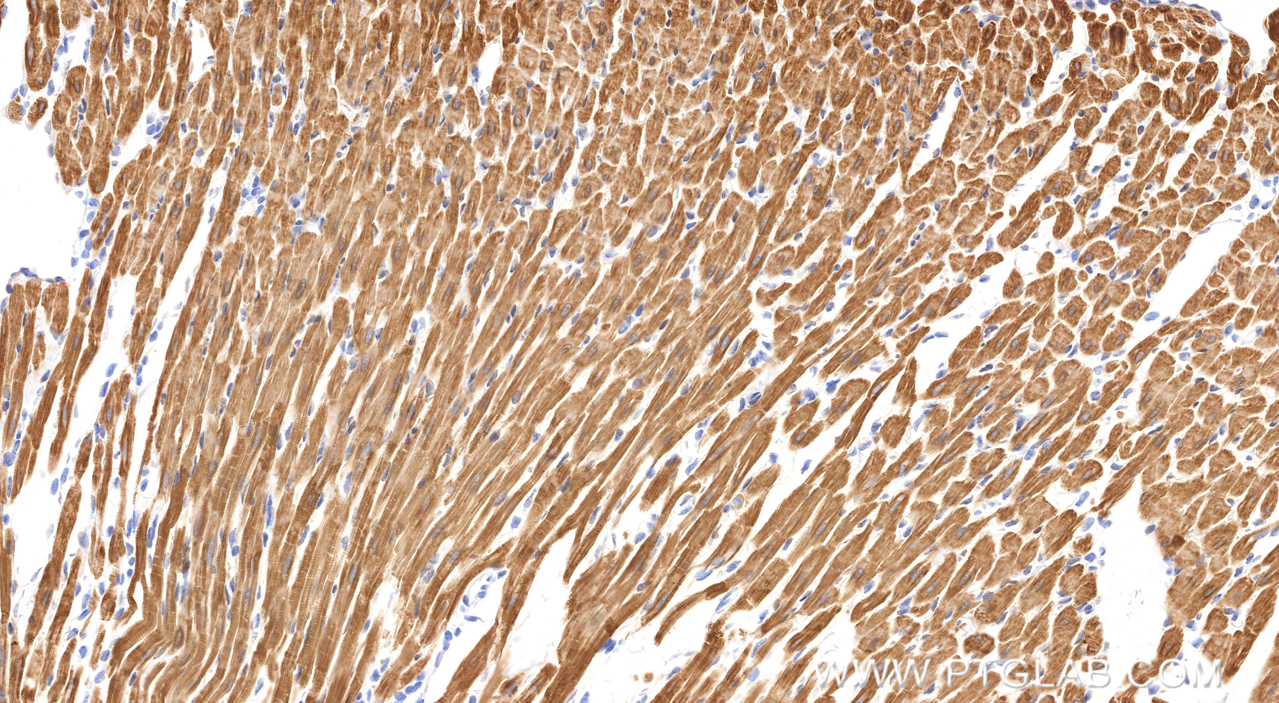 IHC staining of rat heart using 86791-1-RR Immunohistochemistry (IHC) staining of rat heart tissue using Cardiac Troponin I Recombinant monoclonal antibody (86791-1-RR)