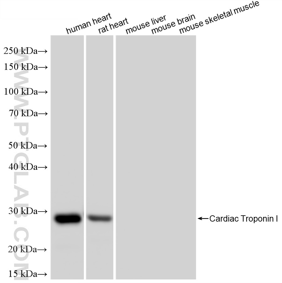 WB analysis using 86791-1-RR Western Blot (WB) analysis of various lysates using Cardiac Troponin I Recombinant monoclonal antibody (86791-1-RR)