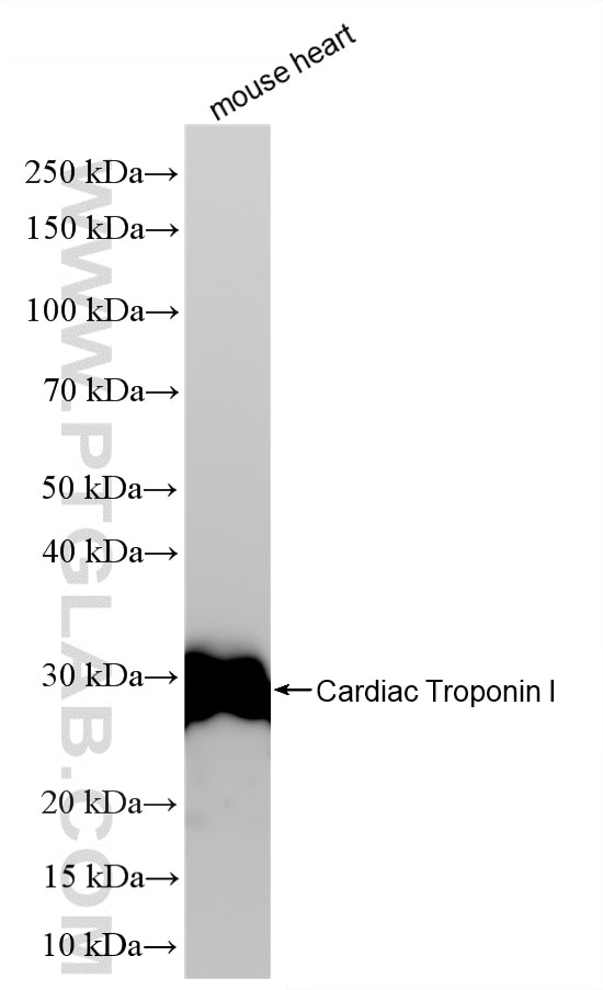 WB analysis using 86791-1-RR Western Blot (WB) analysis of various lysates using Cardiac Troponin I Recombinant monoclonal antibody (86791-1-RR)