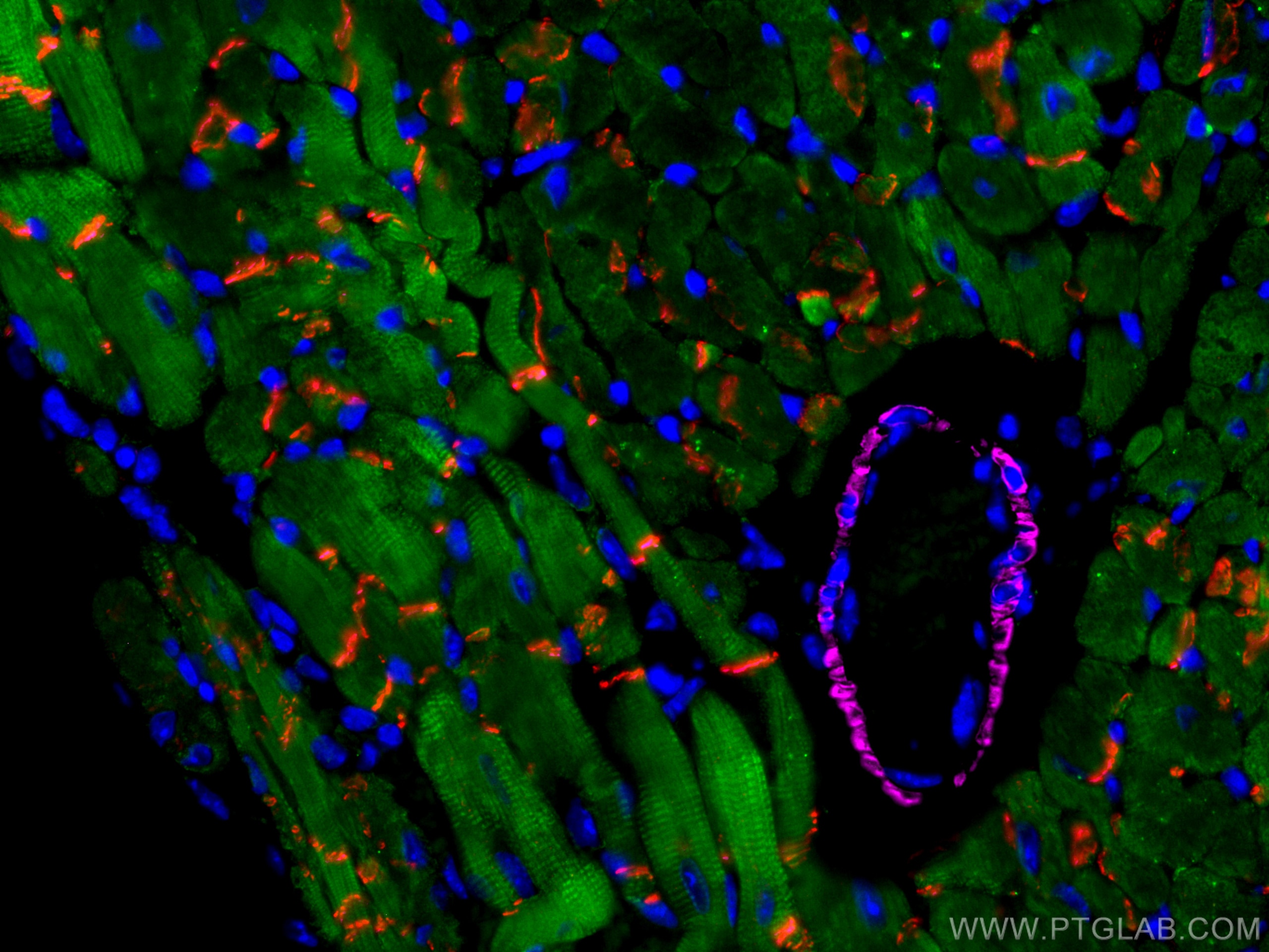 Immunofluorescence (IF) / fluorescent staining of mouse heart tissue using CoraLite® Plus 488-conjugated Cardiac Troponin I M (CL488-66376)
