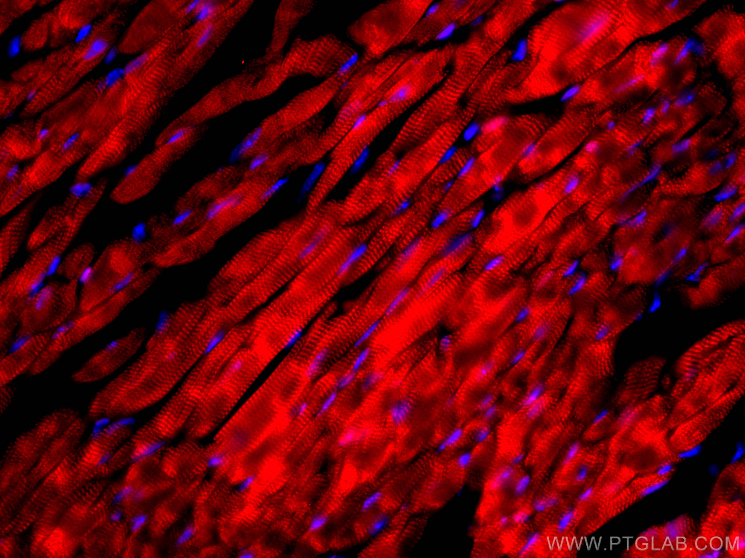 Immunofluorescence (IF) / fluorescent staining of mouse heart tissue using CoraLite®594-conjugated Cardiac Troponin I Monoclo (CL594-66376)