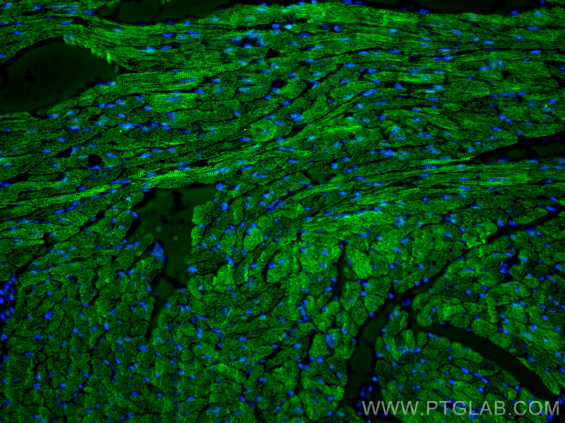 Immunofluorescence (IF) / fluorescent staining of mouse heart tissue using Cardiac Troponin T Polyclonal antibody (26592-1-AP)
