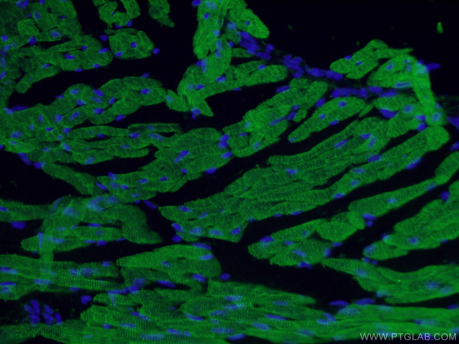 Immunofluorescence (IF) / fluorescent staining of mouse heart tissue using Cardiac Troponin T Polyclonal antibody (26592-1-AP)
