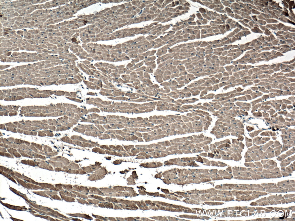 Immunohistochemistry (IHC) staining of mouse heart tissue using Cardiac Troponin T Polyclonal antibody (26592-1-AP)