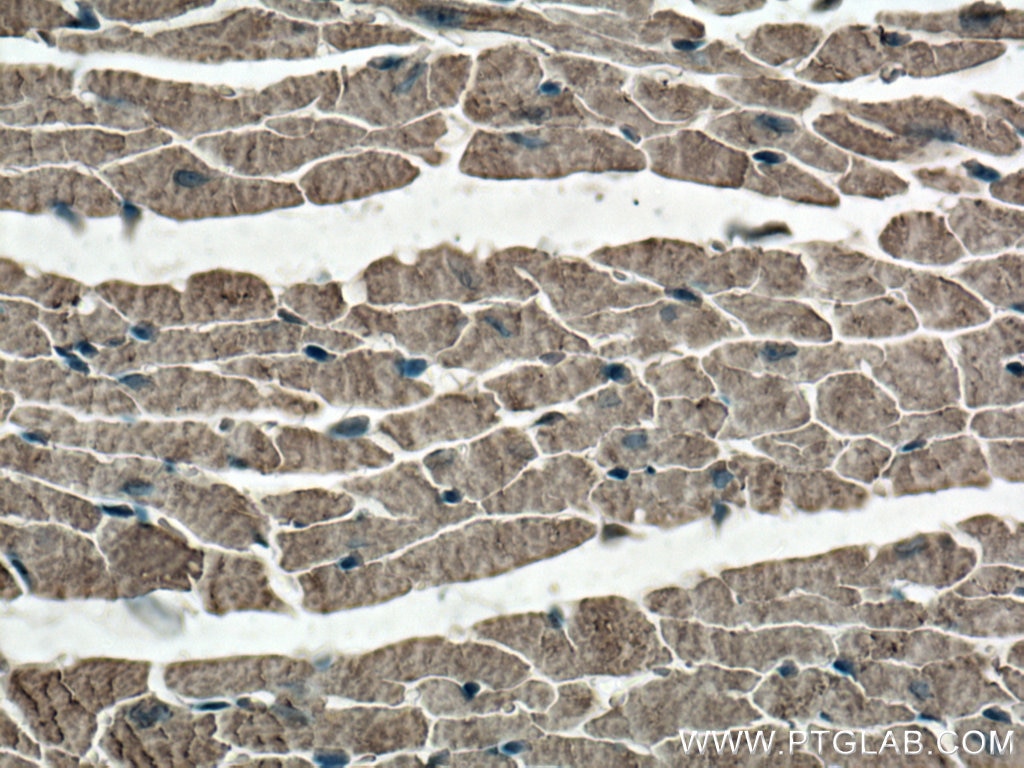 Immunohistochemistry (IHC) staining of mouse heart tissue using Cardiac Troponin T Polyclonal antibody (26592-1-AP)