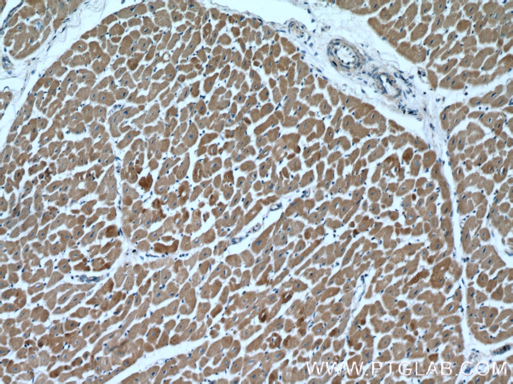 Immunohistochemistry (IHC) staining of human heart tissue using Cardiac Troponin T Polyclonal antibody (26592-1-AP)