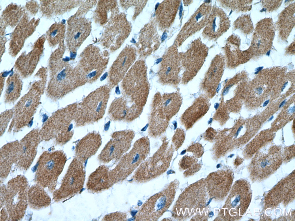 Immunohistochemistry (IHC) staining of human heart tissue using Cardiac Troponin T Polyclonal antibody (26592-1-AP)