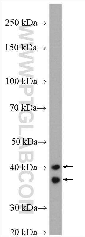 Western Blot (WB) analysis of rat heart tissue using Cardiac Troponin T Polyclonal antibody (26592-1-AP)