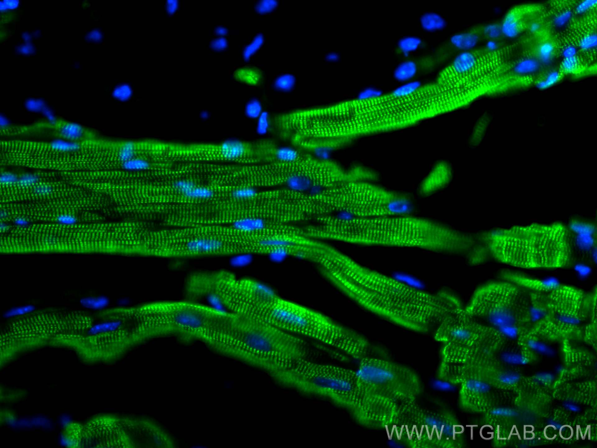 Immunofluorescence (IF) / fluorescent staining of mouse heart tissue using Cardiac Troponin T Monoclonal antibody (68300-1-Ig)