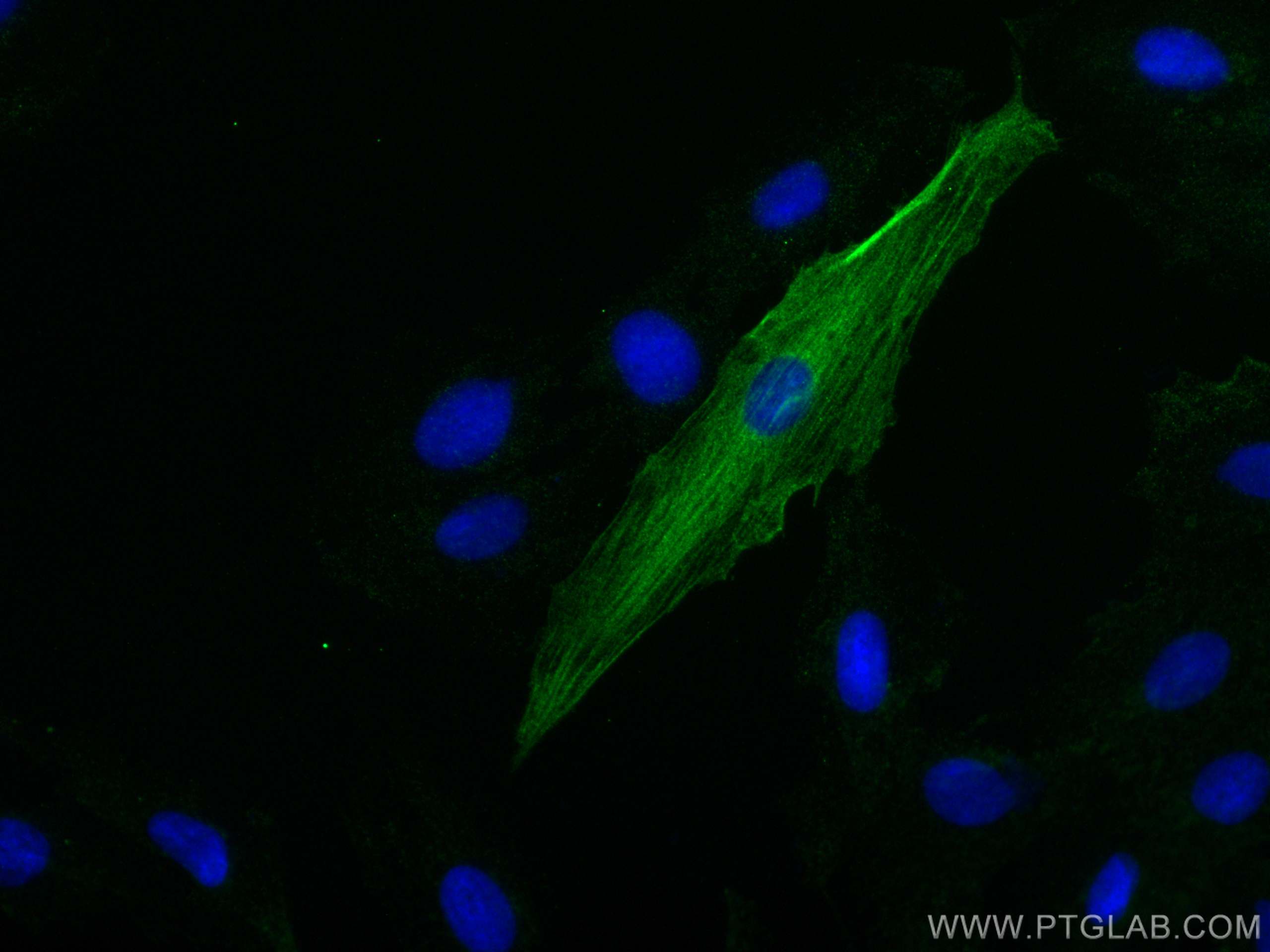 Immunofluorescence (IF) / fluorescent staining of H9C2 cells using Cardiac Troponin T Monoclonal antibody (68300-1-Ig)