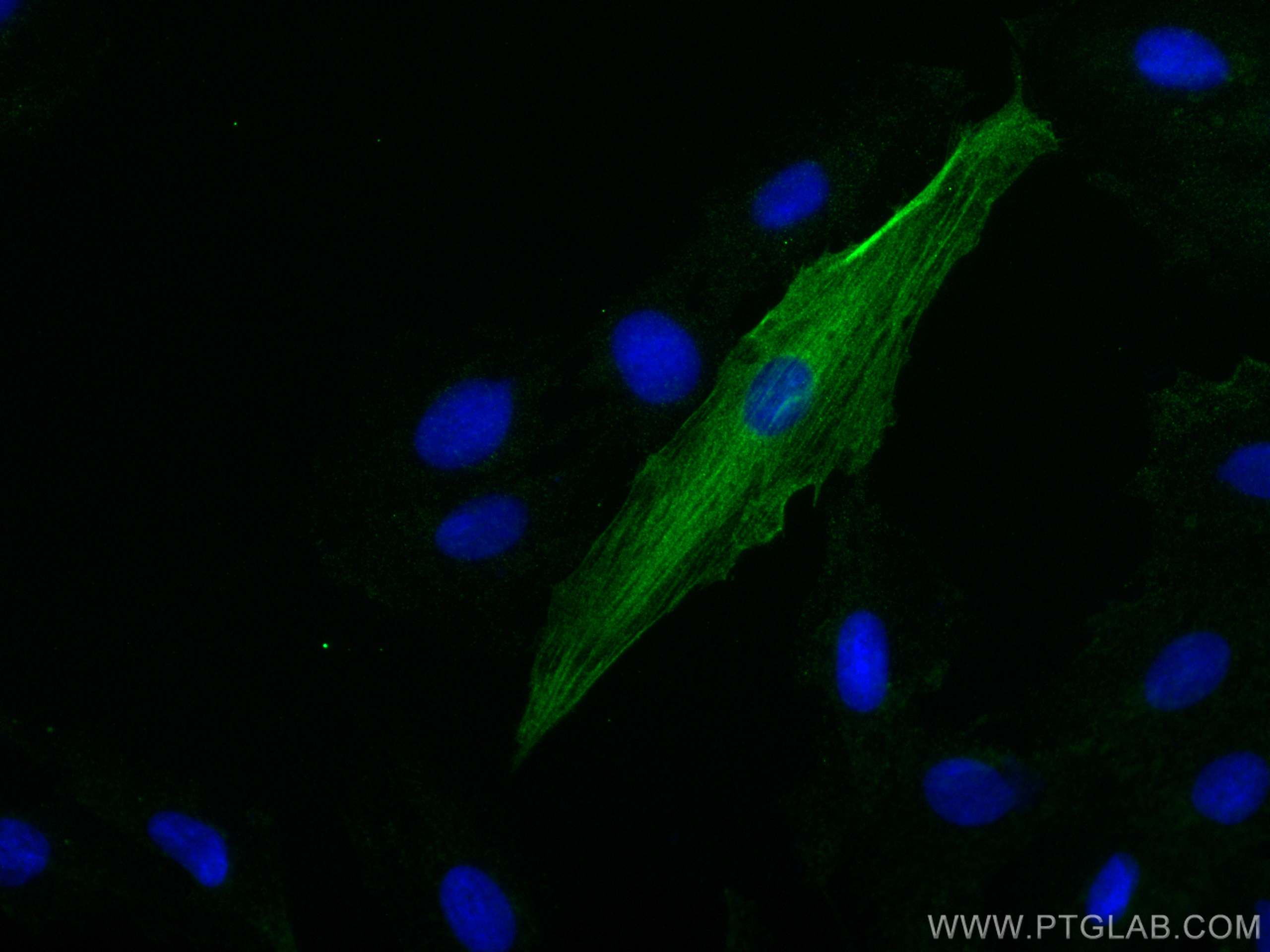 IF Staining of H9C2 using 68300-1-Ig