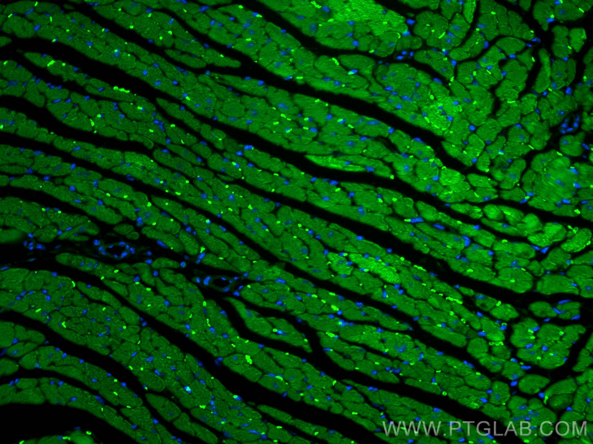 Immunofluorescence (IF) / fluorescent staining of mouse heart tissue using CoraLite® Plus 488-conjugated Cardiac Troponin T P (CL488-26592)