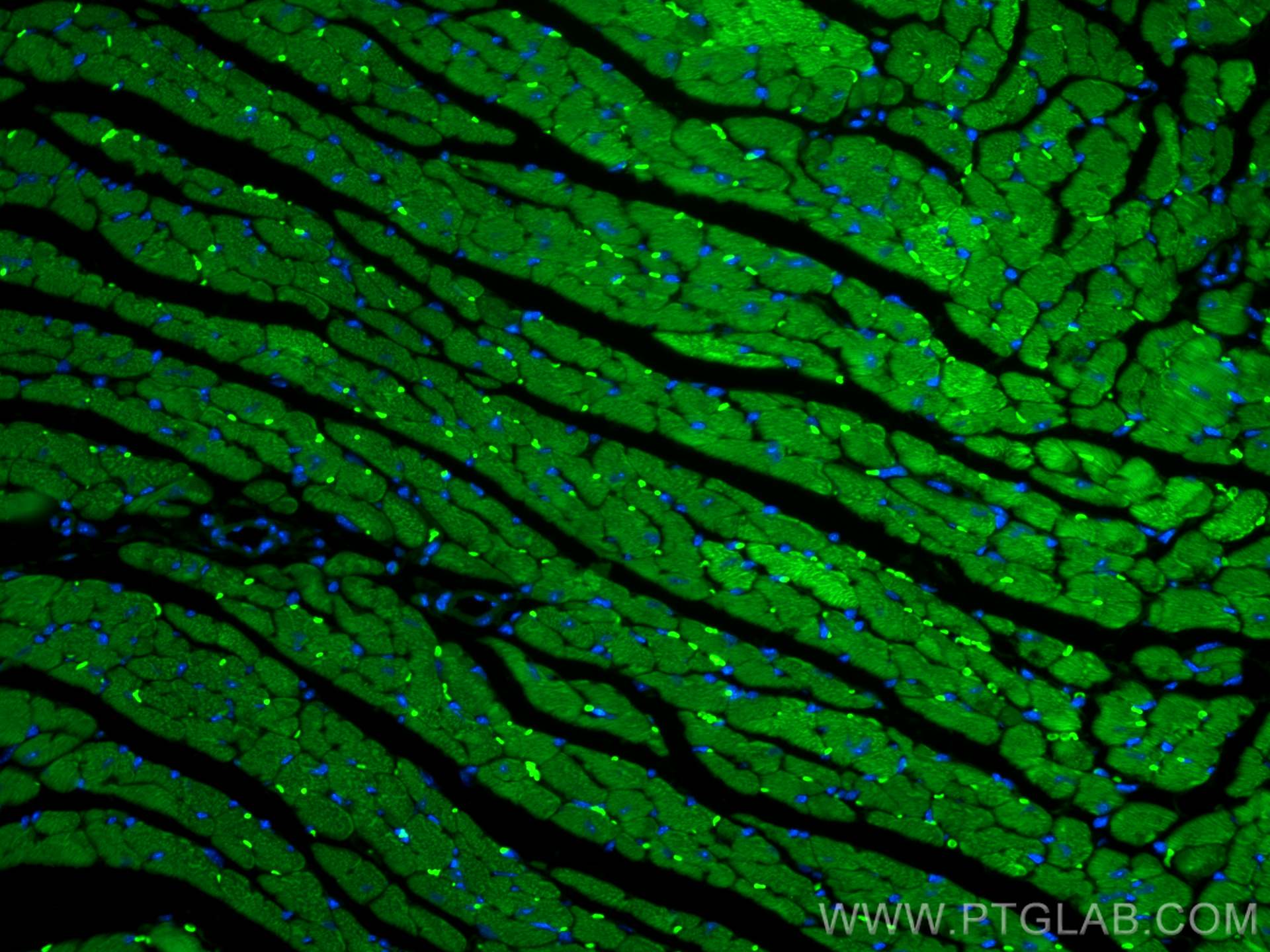 IF Staining of mouse heart using CL488-26592